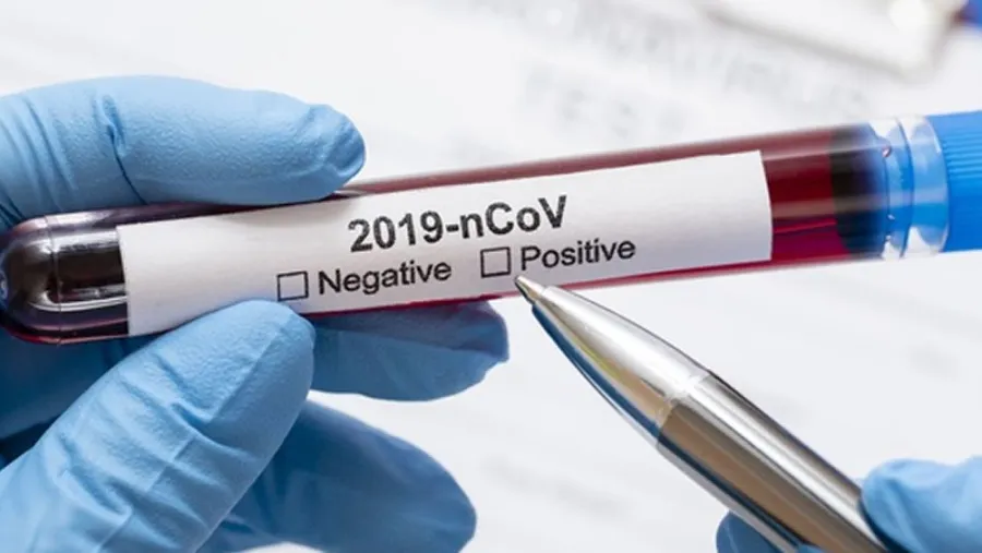 coronavirus laboratorio
