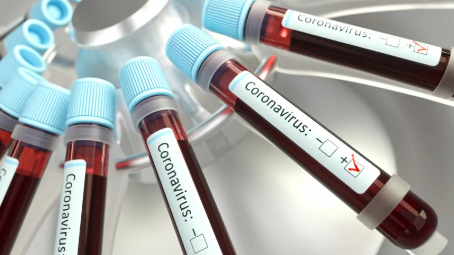 coronavirus laboratorio