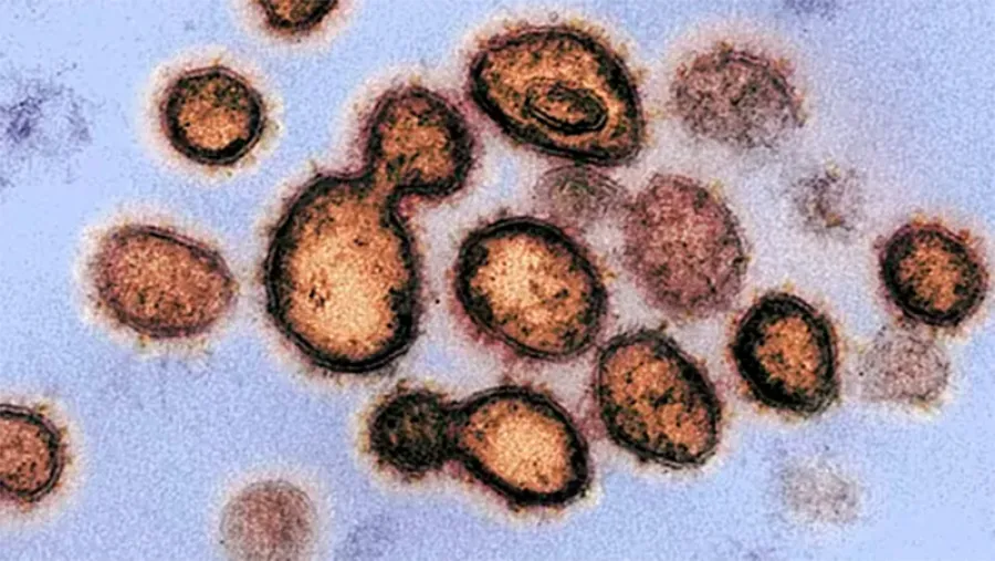 coronavirus