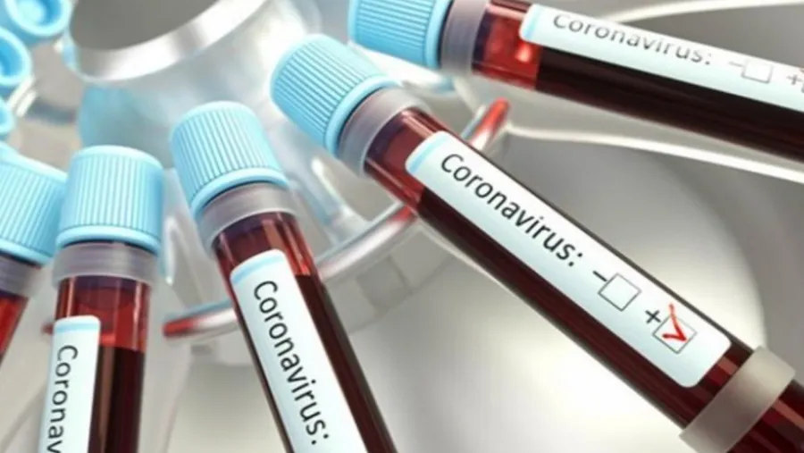 Coronavirus Coronavirus