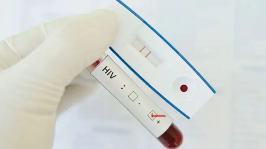 HIV test