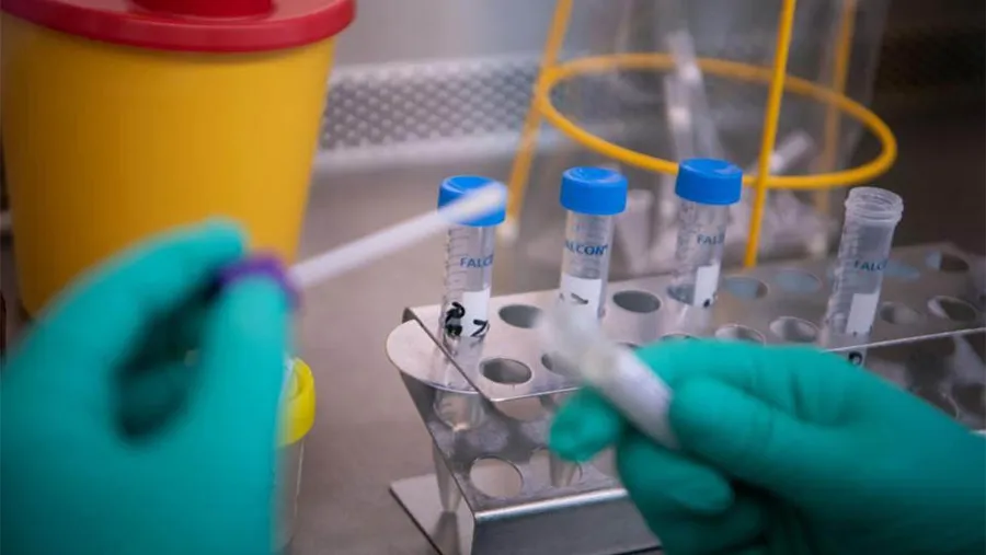Aseguran que la producción de vacuna contra el coronavirus a gran escala comenzará en septiembre. Aseguran que la producción de vacuna contra el coronavirus a gran escala comenzará en septiembre.
