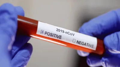 Coronavirus 