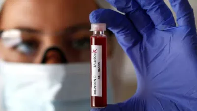 coronavirus laboratorio