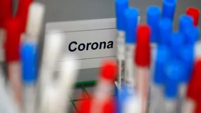 coronavirus muestras