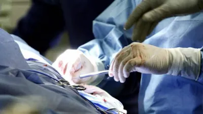 Ablación en Entre Ríos.