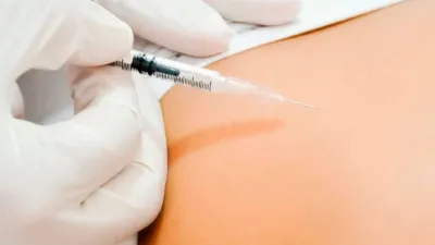 Carboxiterapia