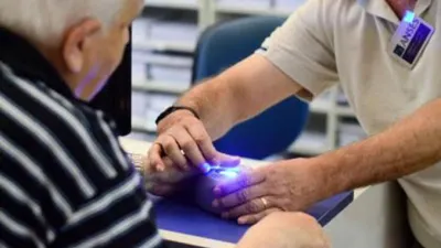 ANSES huella dactilar