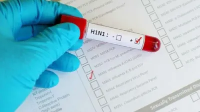 H1N1