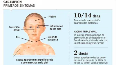 sarampión síntomas