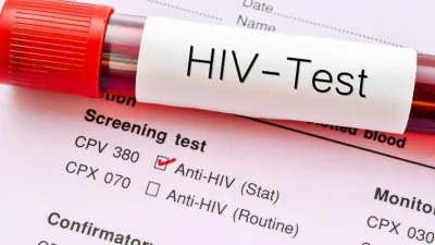 vacuna HIV