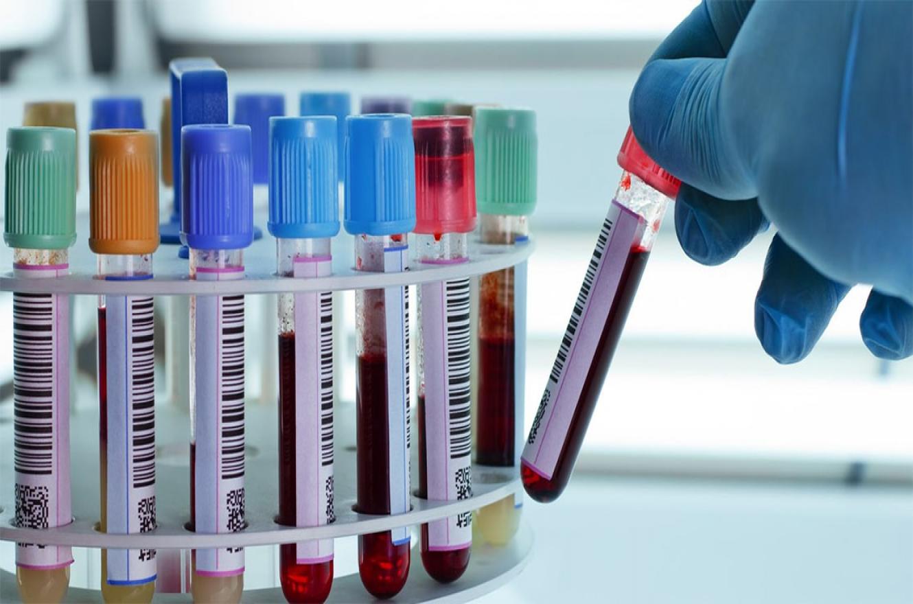 El Colegio de Bioquímicos de Entre Ríos confirmó que a partir de hoy los afiliados al Iosper no contarán con cobertura. Reprochan la falta de diálogo de la gestión interventora.