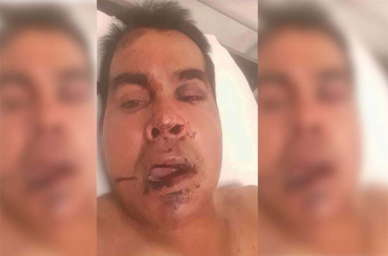 camionero golpeado