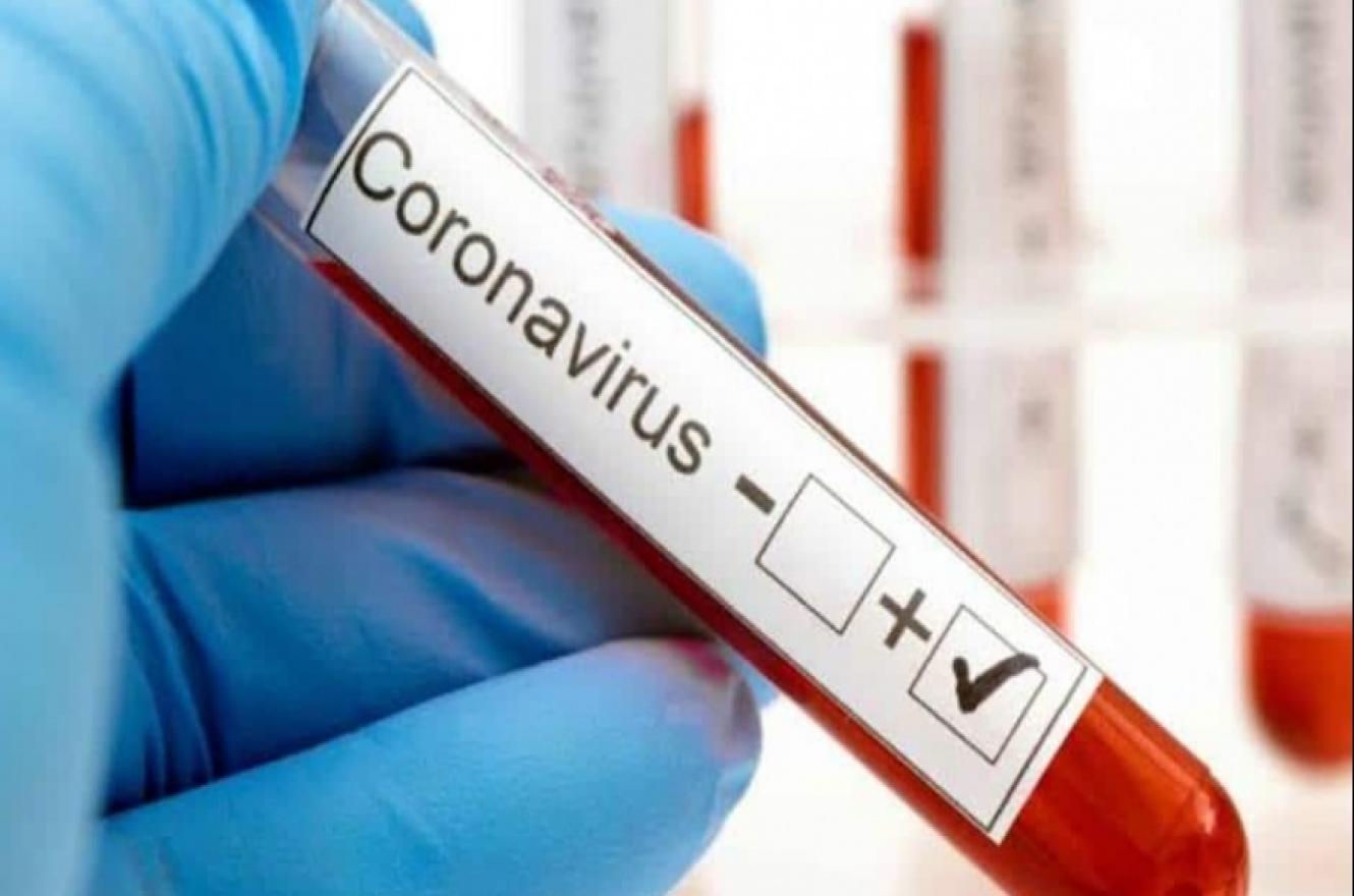 coronavirus