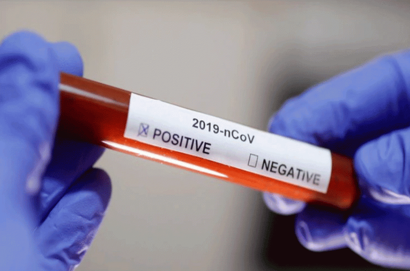 Coronavirus.