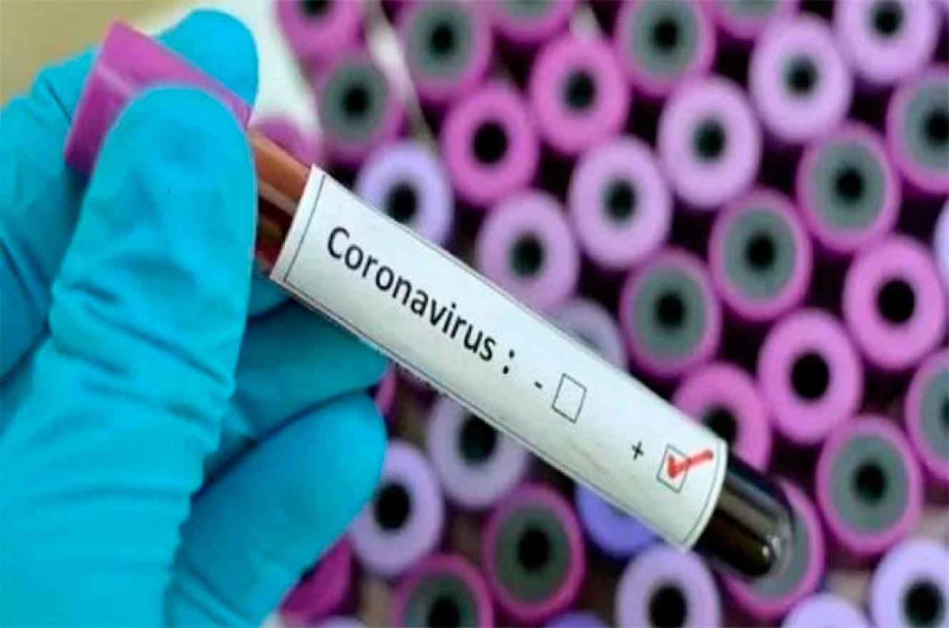 coronavirus laboratorio