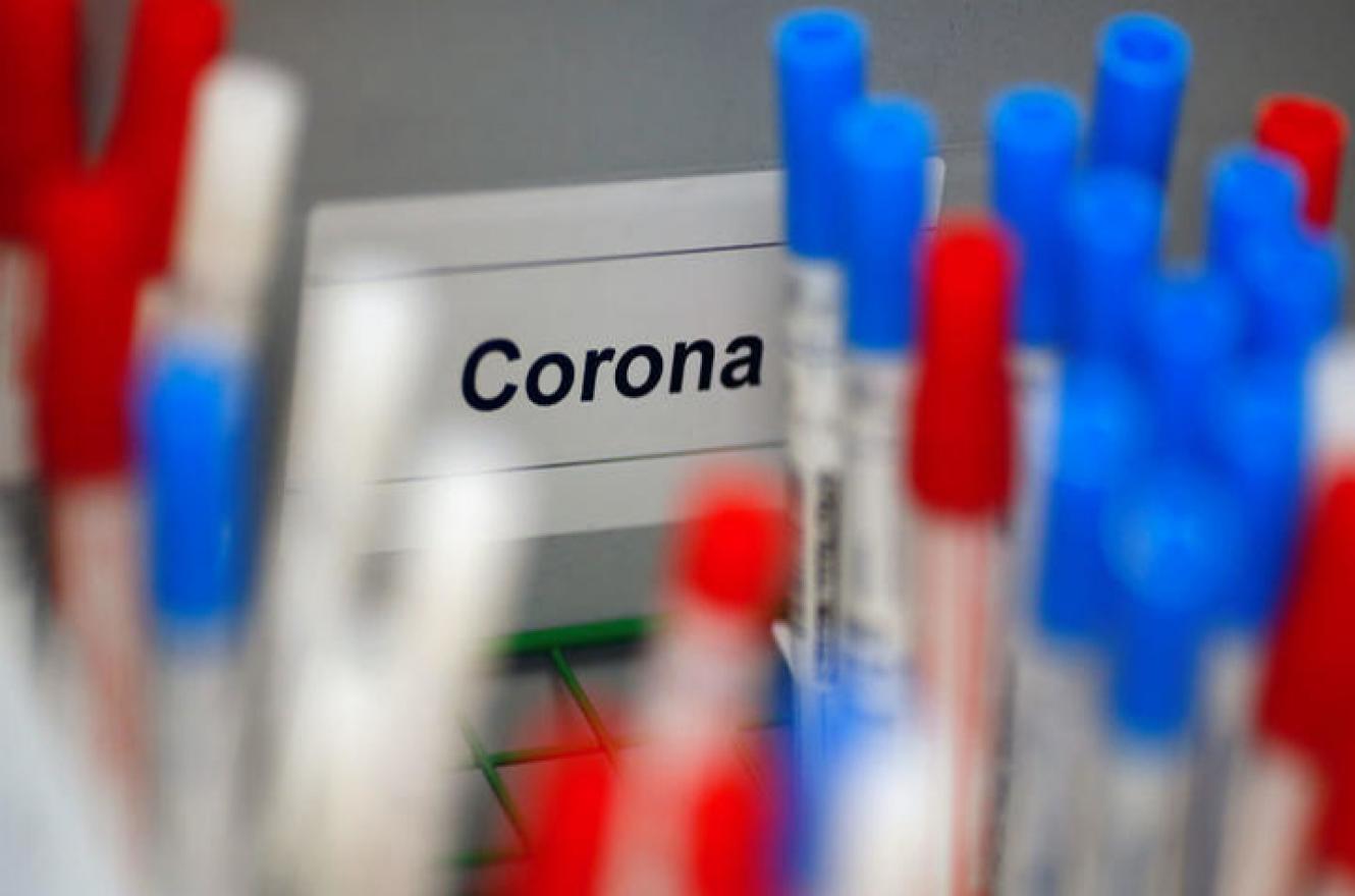 coronavirus laboratorio