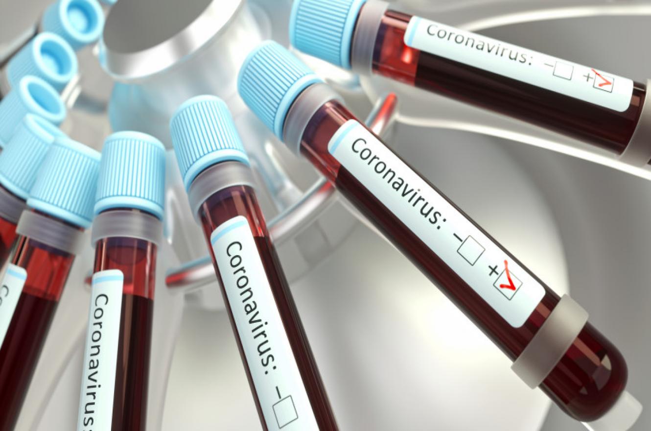 coronavirus muestras 