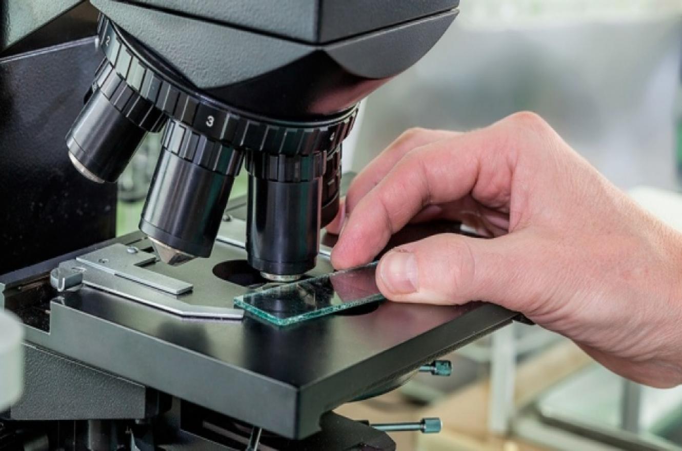 coronavirus microscopio