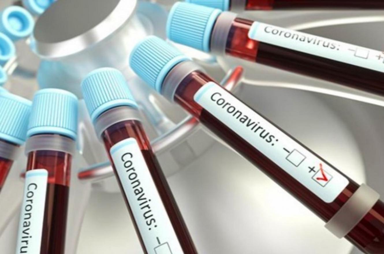 Coronavirus