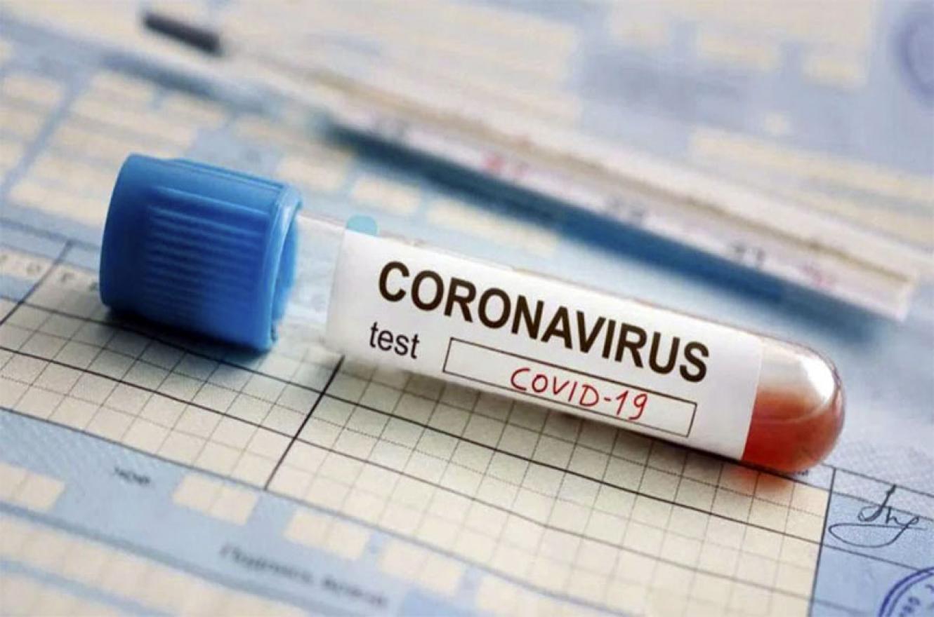 En la provincia se registraron hoy 706 casos de Covid-19 y el total acumulado asciende a 34.930 personas confirmadas con esa enfermedad.