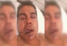 camionero golpeado