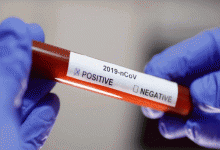 Coronavirus 