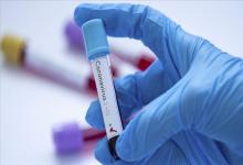 coronavirus laboratorio
