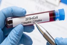 coronavirus 