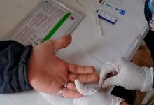Desde el hospital Centenario de Gualeguaychú se admitió que este año creció un 30 por ciento la detección de pacientes con VIH respecto de 2018, aunque estiman que “probablemente esté relacionado con una mayor oferta de testeos para toda la población y no por un aumento real de los casos”.