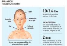sarampión síntomas